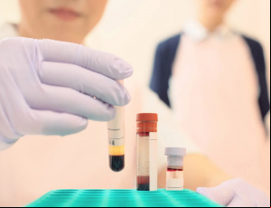 Notícia - Urussanga credencia novos laboratórios e reforça o atendimento em exames de saúde